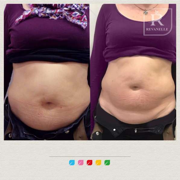 МАССАЖ в Волгограде фото 5