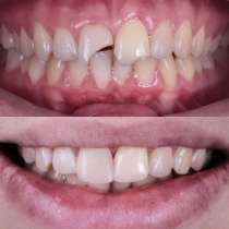 Стоматологический комплекс в Марьино - ПрезиДЕНТ, в Москве